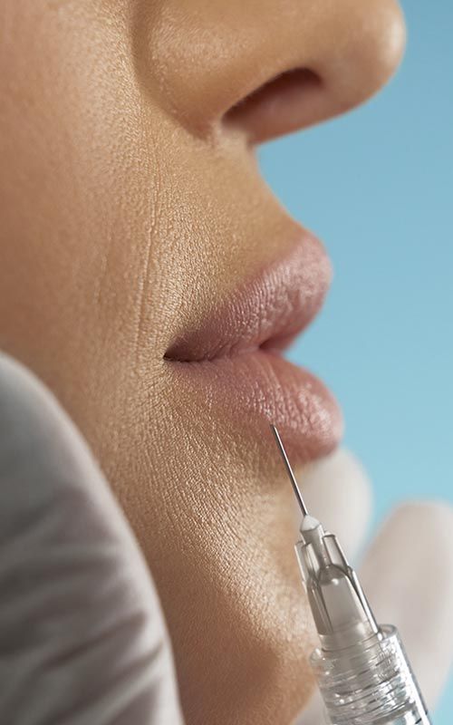 Aumento de labios con acido hialuronico