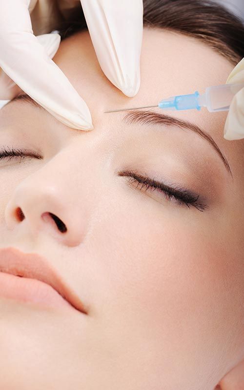 Infiltracion de botox en arruga del entrcejo