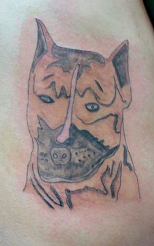 Tatuaje feo para quitar con láser