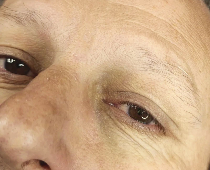 Mirada de mujer antes del tratamiento con microblading de cejas