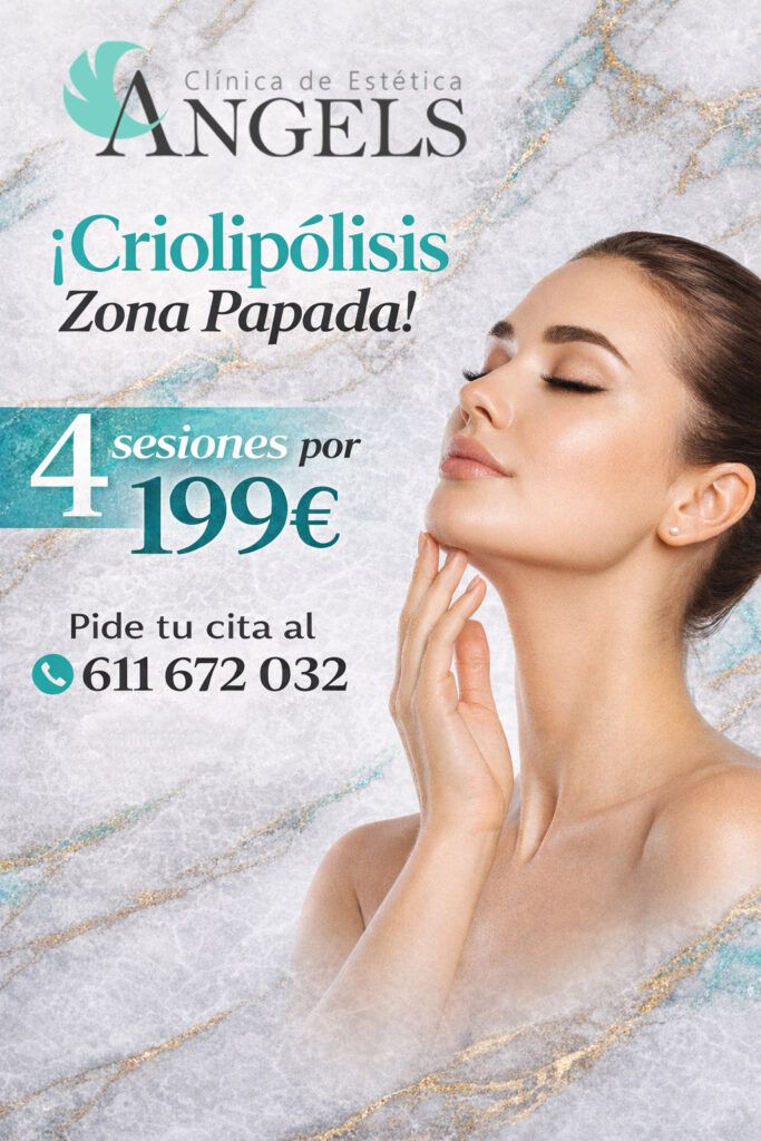 Promo Criolipólisis Papada en Sevilla